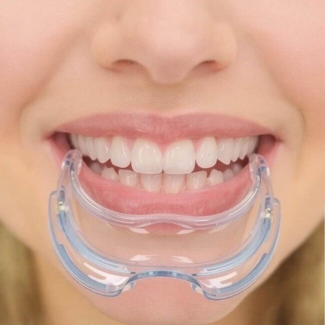 Invisalign vs tradycyjny aparat